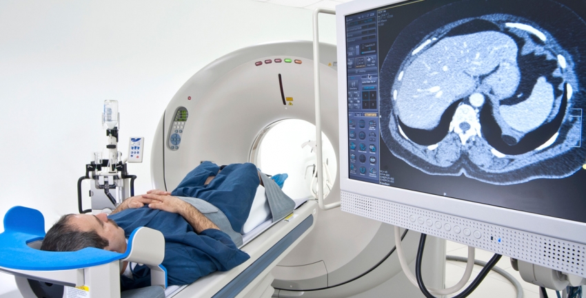 Photo of Colon Screening